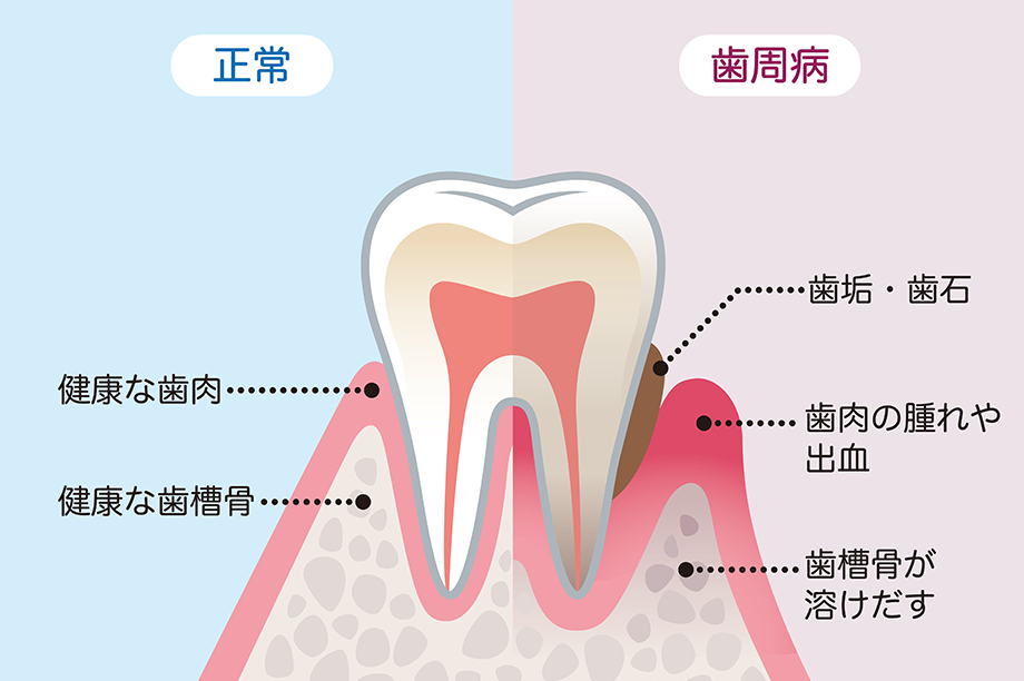 症状に合わせた治療法